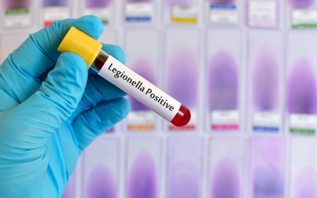 Innovative Solutions for Addressing Legionella in Modern Healthcare
